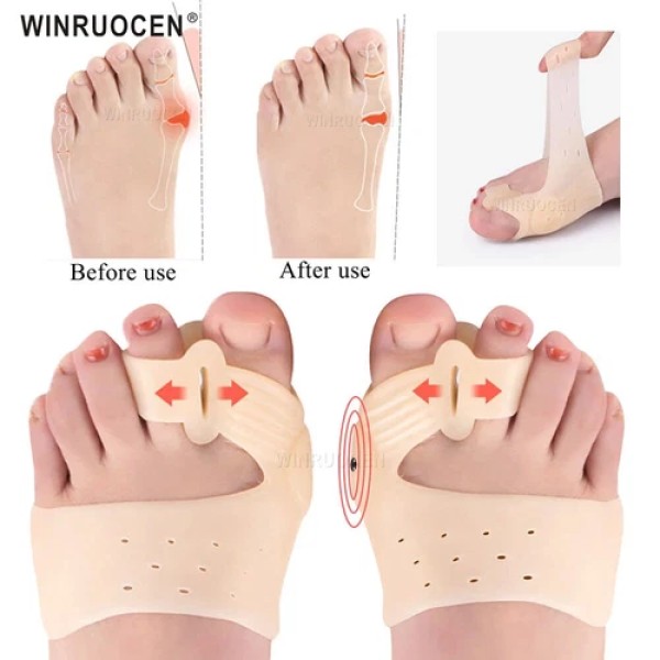 Magnet Toe Corrector. Bunion Corrector & Toe Straightener.Magnetic Therapy Toe AlignerSilicone Toe Separator for Hammer Toe & Overlapping Toes